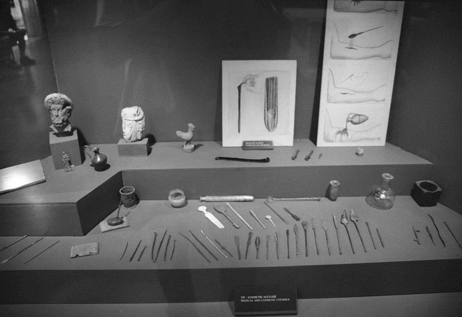 Instruments médicaux de l’époque romaine conservés dans une collection archéologique.
